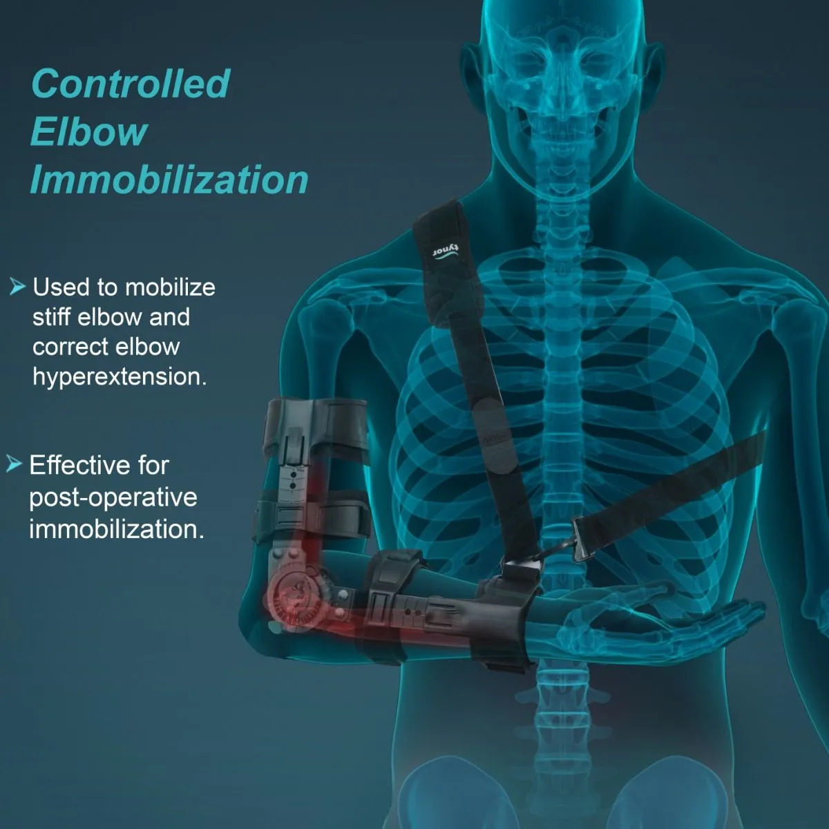 ROM Elbow Brace (tynor) 2