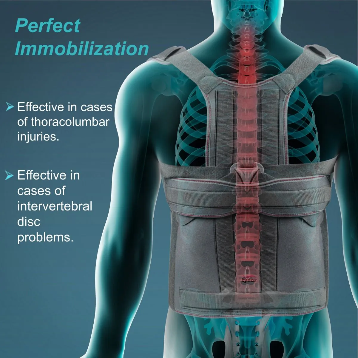 Taylor's Brace (tynor) 2