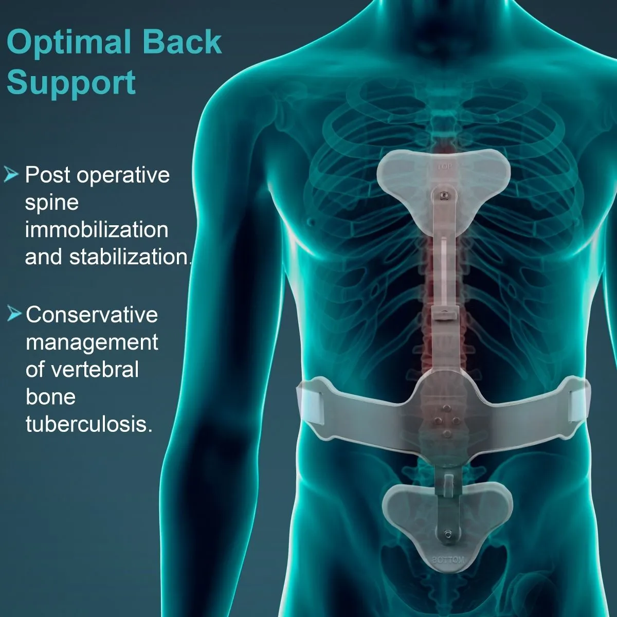 Ash Brace (Hyper Extension Brace) (tynor) 2